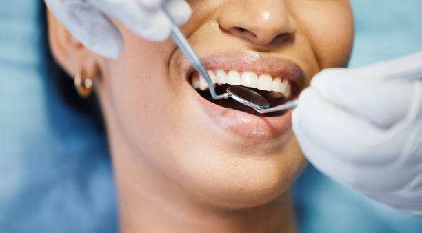 Best Emergency Wisdom Teeth Removal in Mundelein, IL
